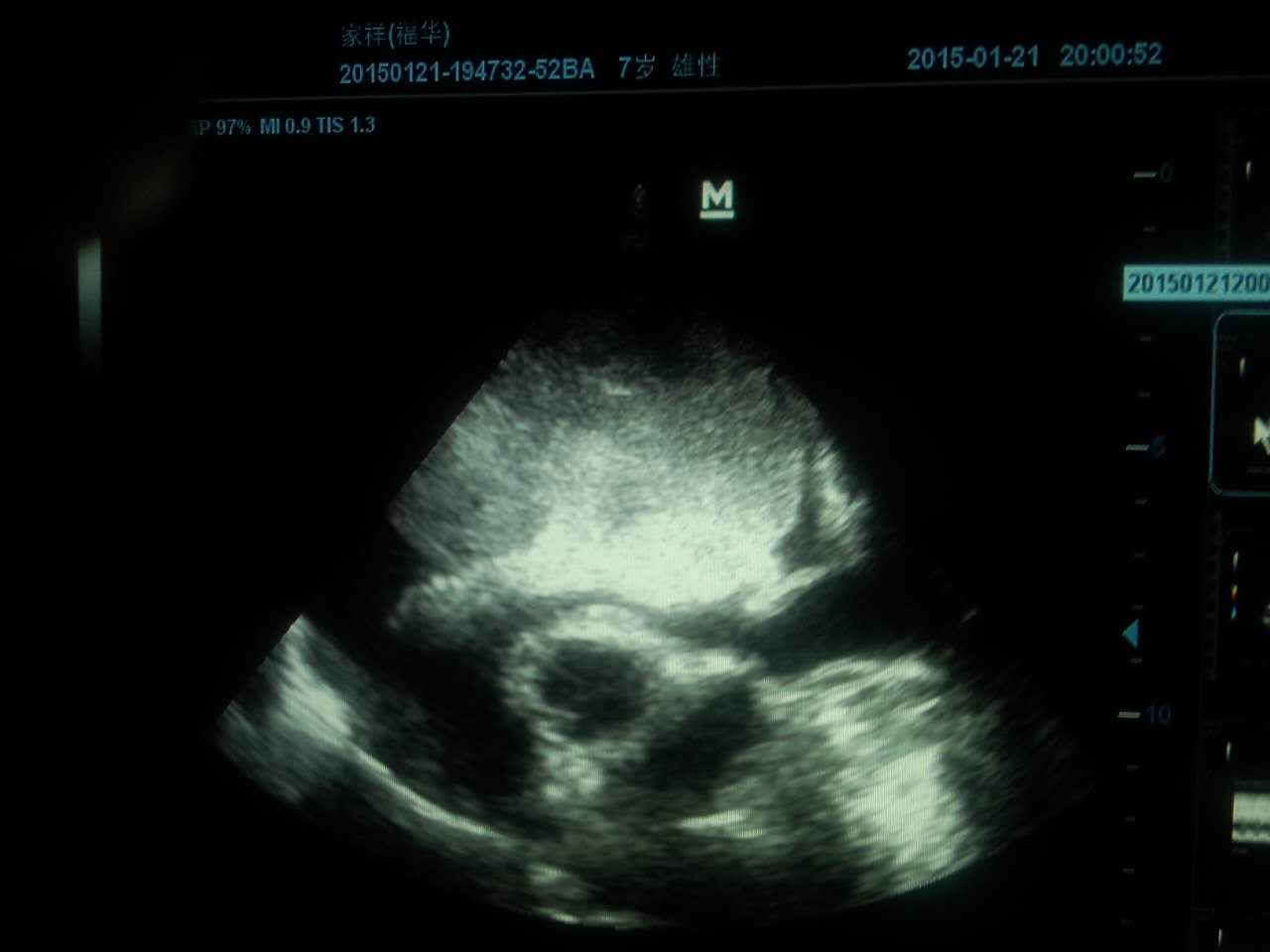 影像科可协助完成各种疑难病例的诊断