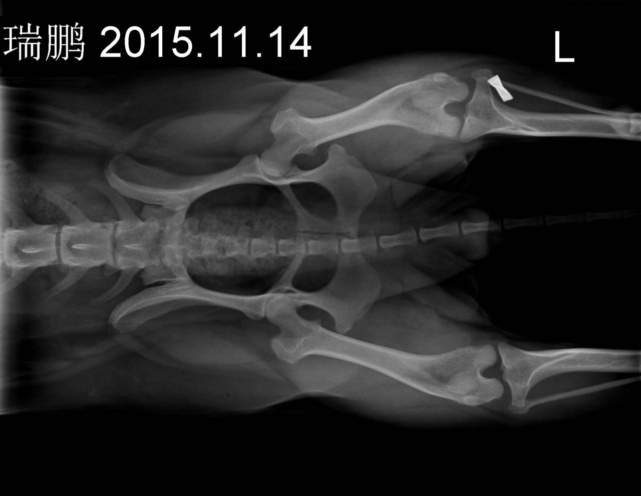 髌骨内脱囊外固定